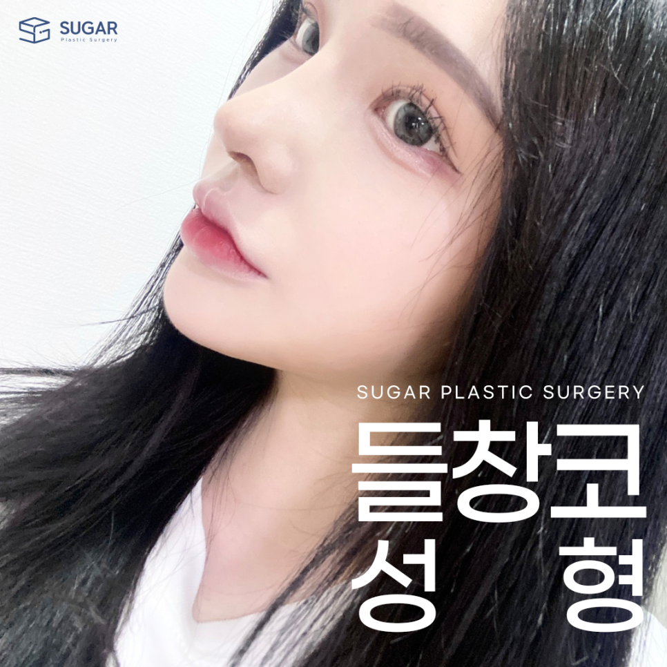들창코 그 원인과 해결방법 관련 이미지 1