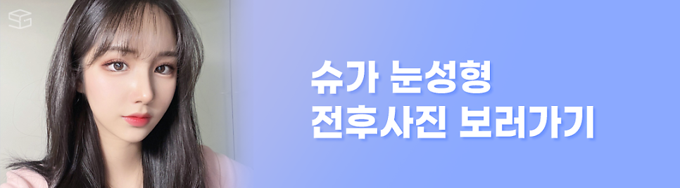 연예인쌍수라인으로 보는 쌍꺼풀라인 관련 이미지 17