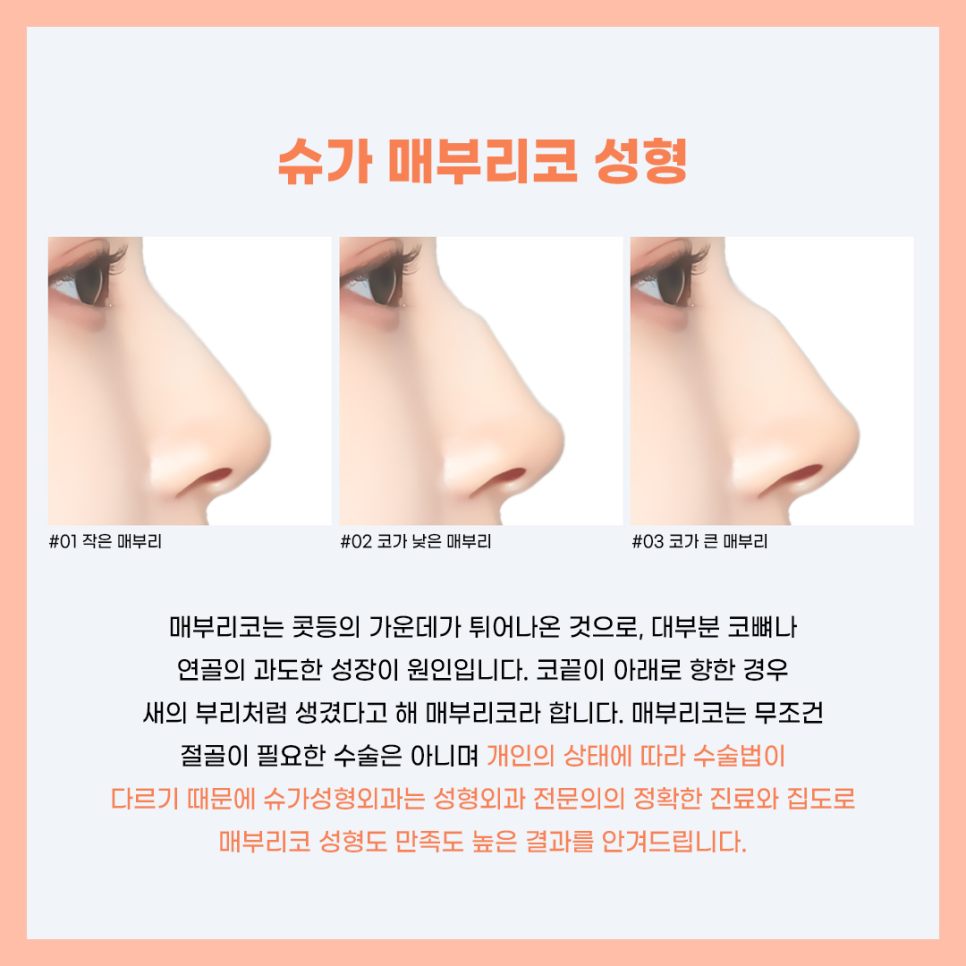 코수술잘하는곳 알아보고 있다면? 관련 이미지 4