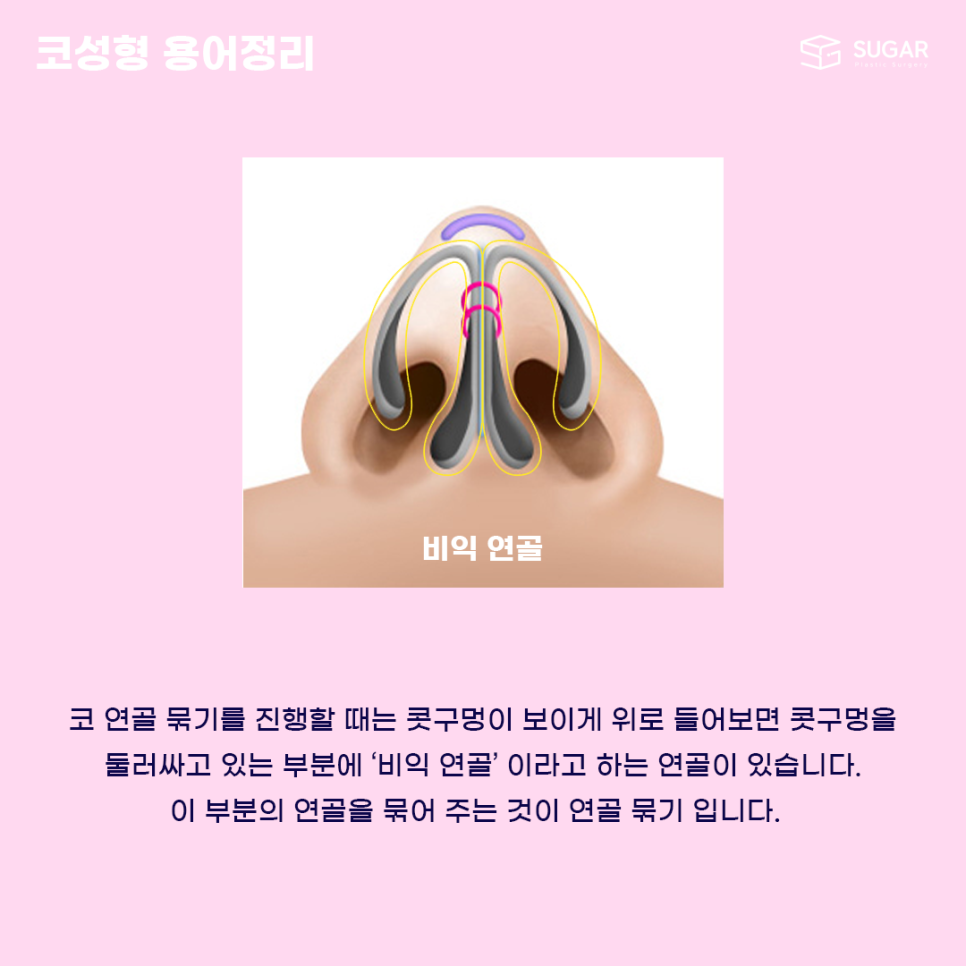 코성형 처음이라면? 용어정리! 관련 이미지 8