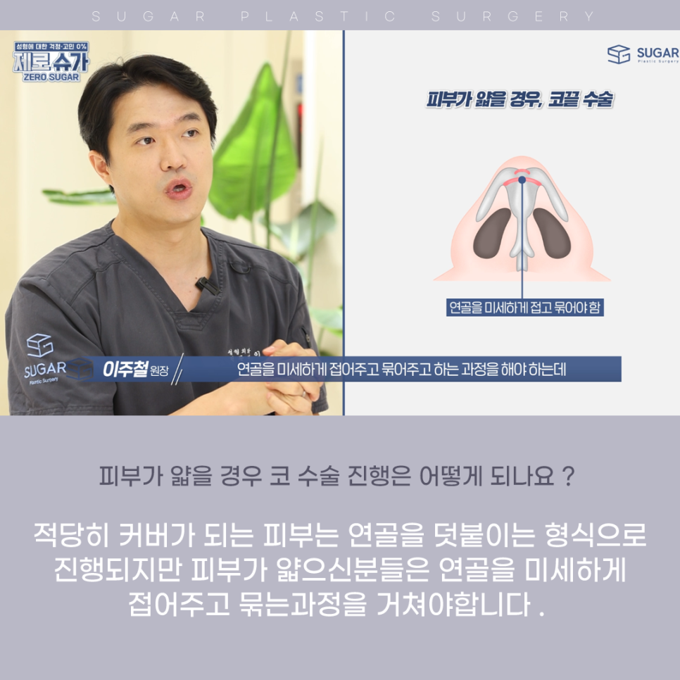 코끝만 올려주세요(feat 무보형물 코성형) 관련 이미지 3