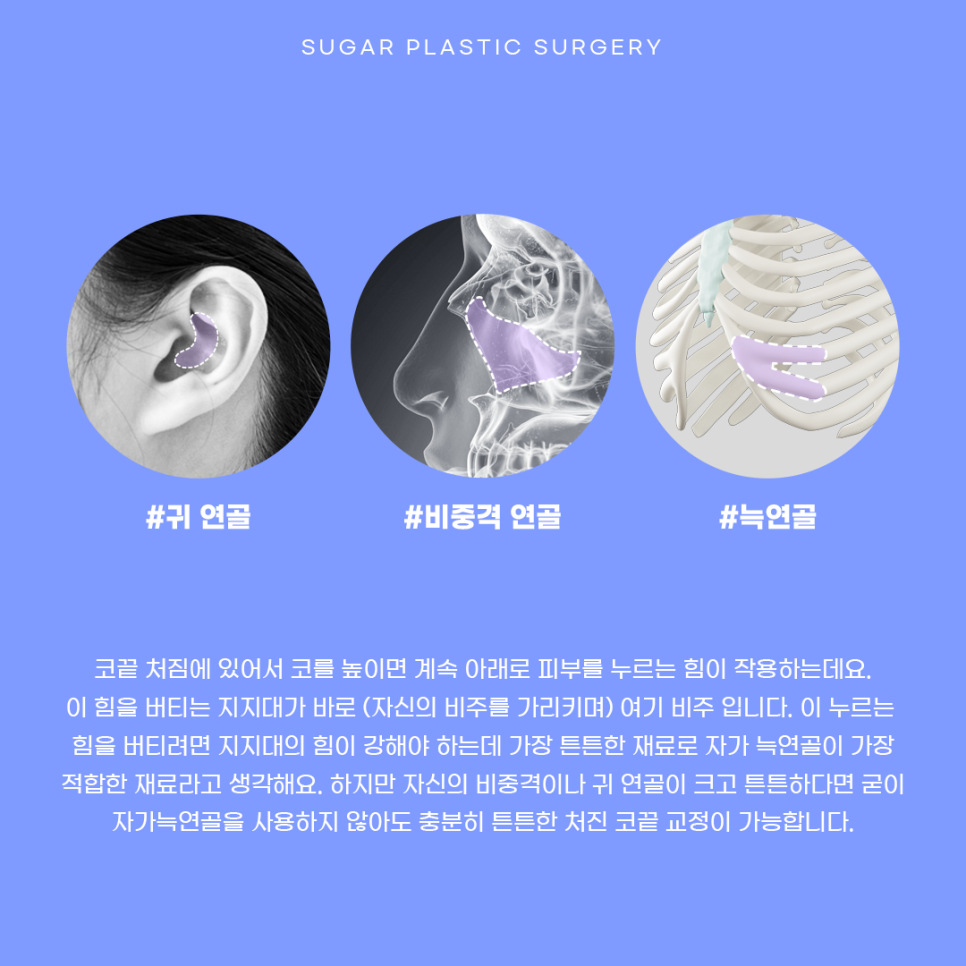 코끝 처짐 원인과 해결 관련 이미지 4