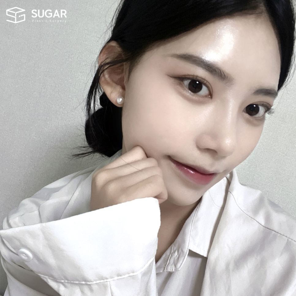 코성형부작용 어디까지 알아봤나요? 관련 이미지 5