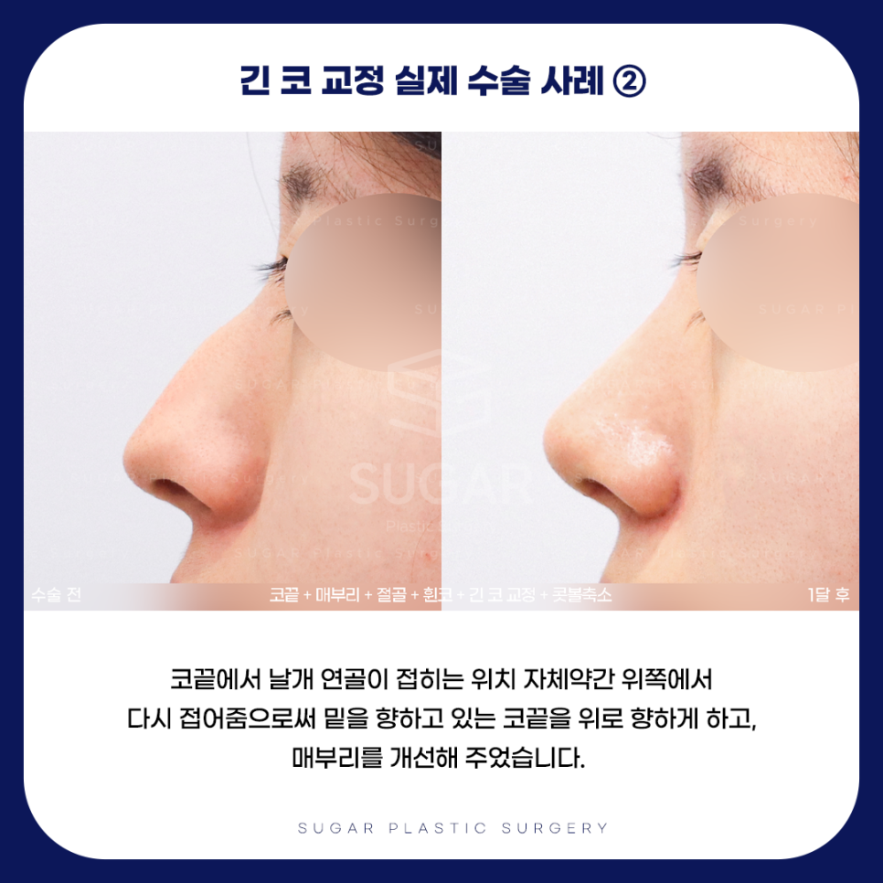 긴코 VS 짧은코 관련 이미지 11