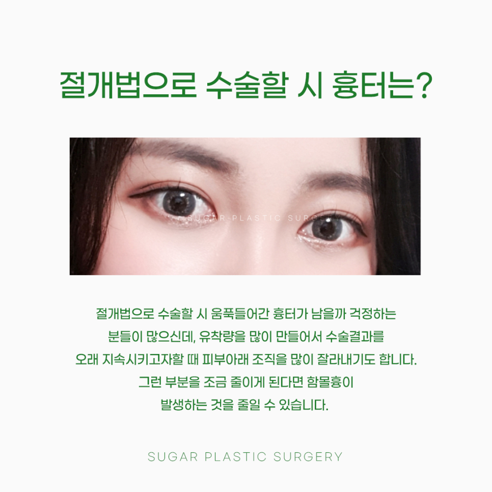 절개 비절개 나에게 맞는 방법은? 관련 이미지 4