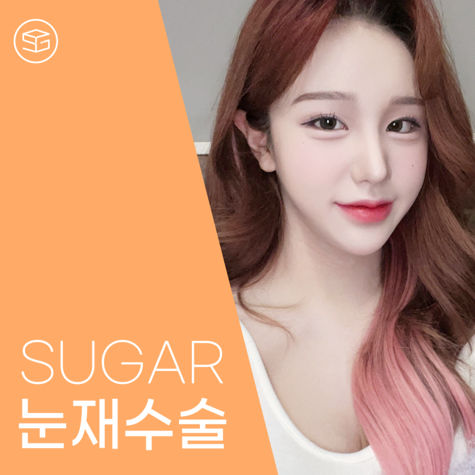 눈재수술 최대 몇 번까지 가능할까? 관련 이미지 1