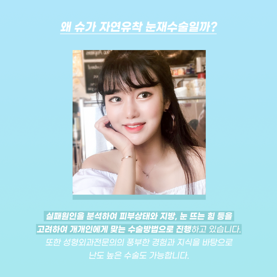 눈재수술 이거 내 얘긴데? 관련 이미지 2