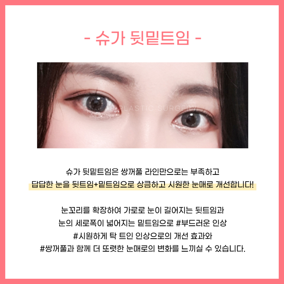 뒷밑트임 붙을까봐 걱정이라면? 관련 이미지 2