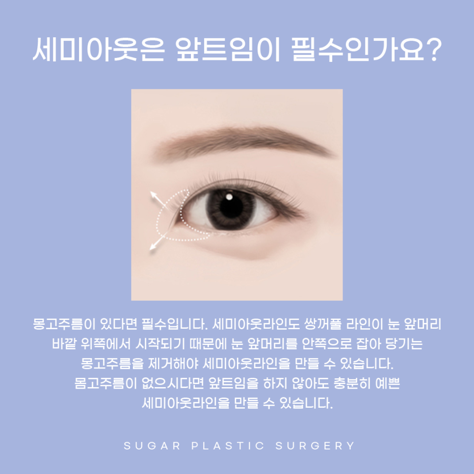 자연화려한 세미아웃 라인 관련 이미지 4