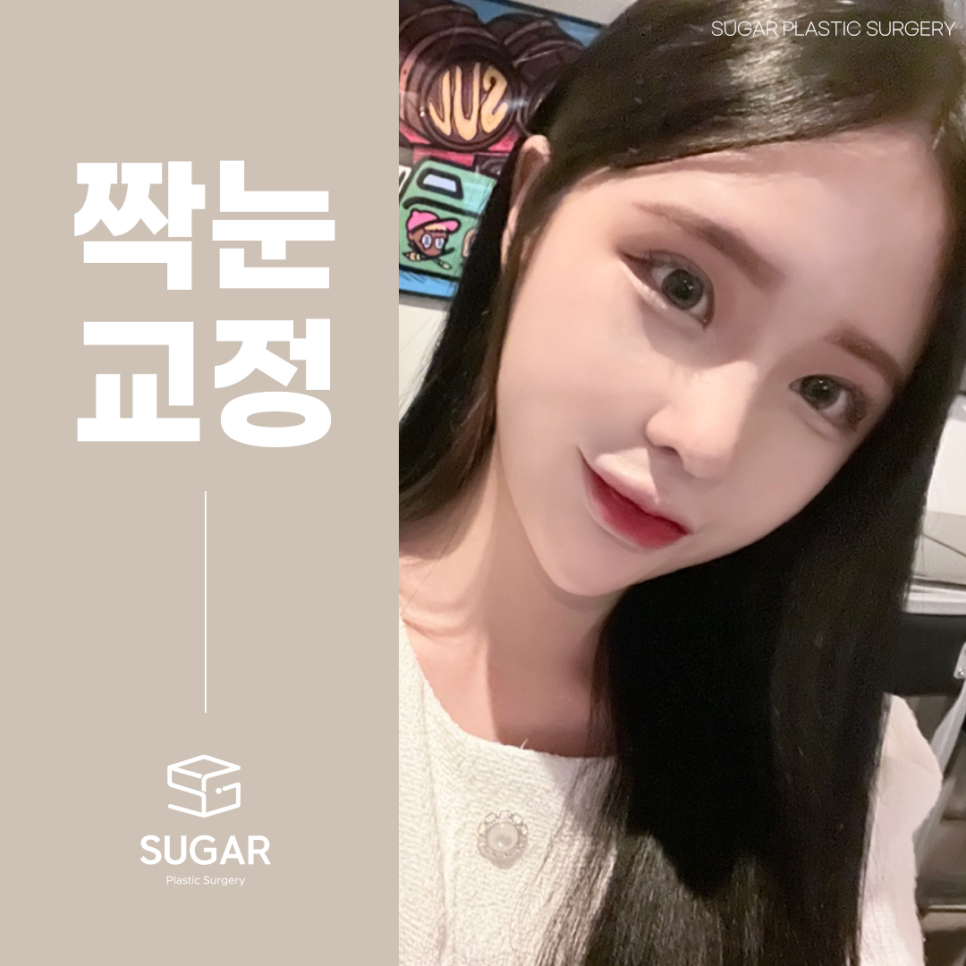 짝눈교정 어떻게 알아볼까 관련 이미지 1