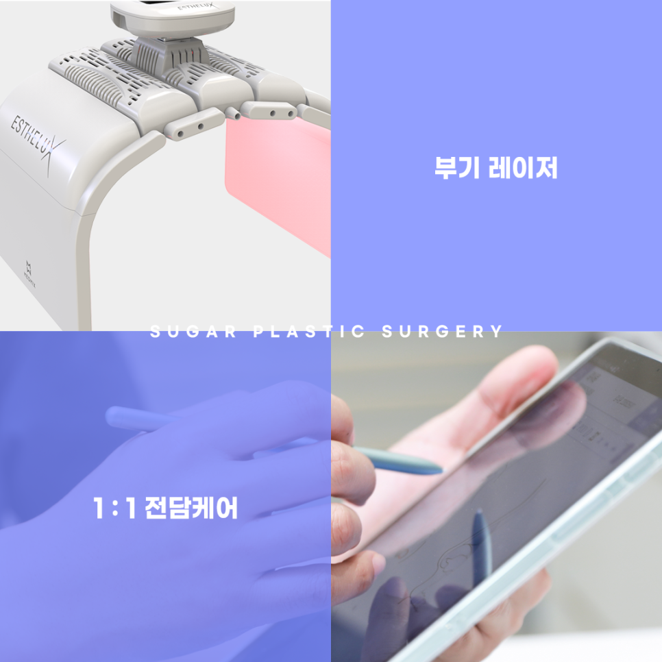 남자성형 대박나는 조건 관련 이미지 15