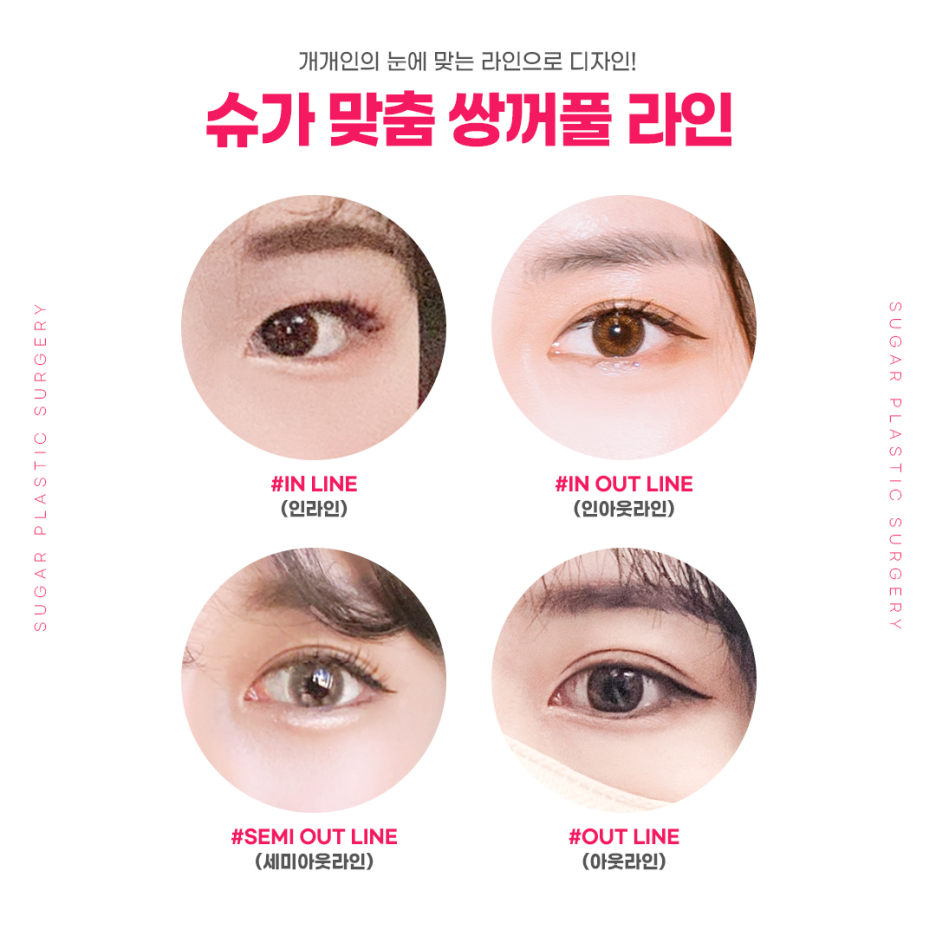 쌍꺼풀라인, 내가 원하는 라인으로 가능할까? 관련 이미지 3