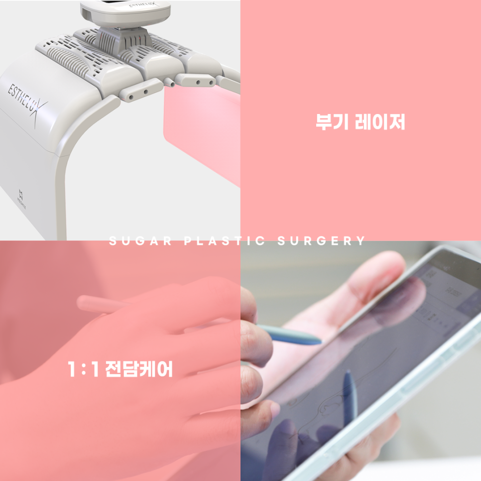 눈재수술 라인높이는 방법 관련 이미지 12