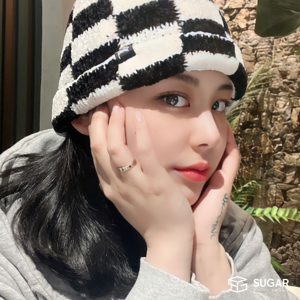코성형 재료 다 알려드림 관련 이미지 10