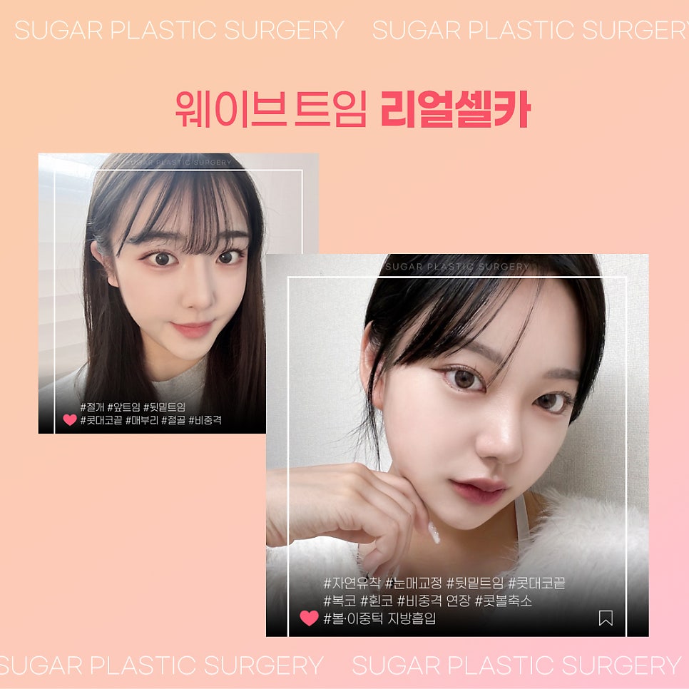 강남눈성형 뒤밑트임잘하는곳 2포인트로 확실하게 관련 이미지 9