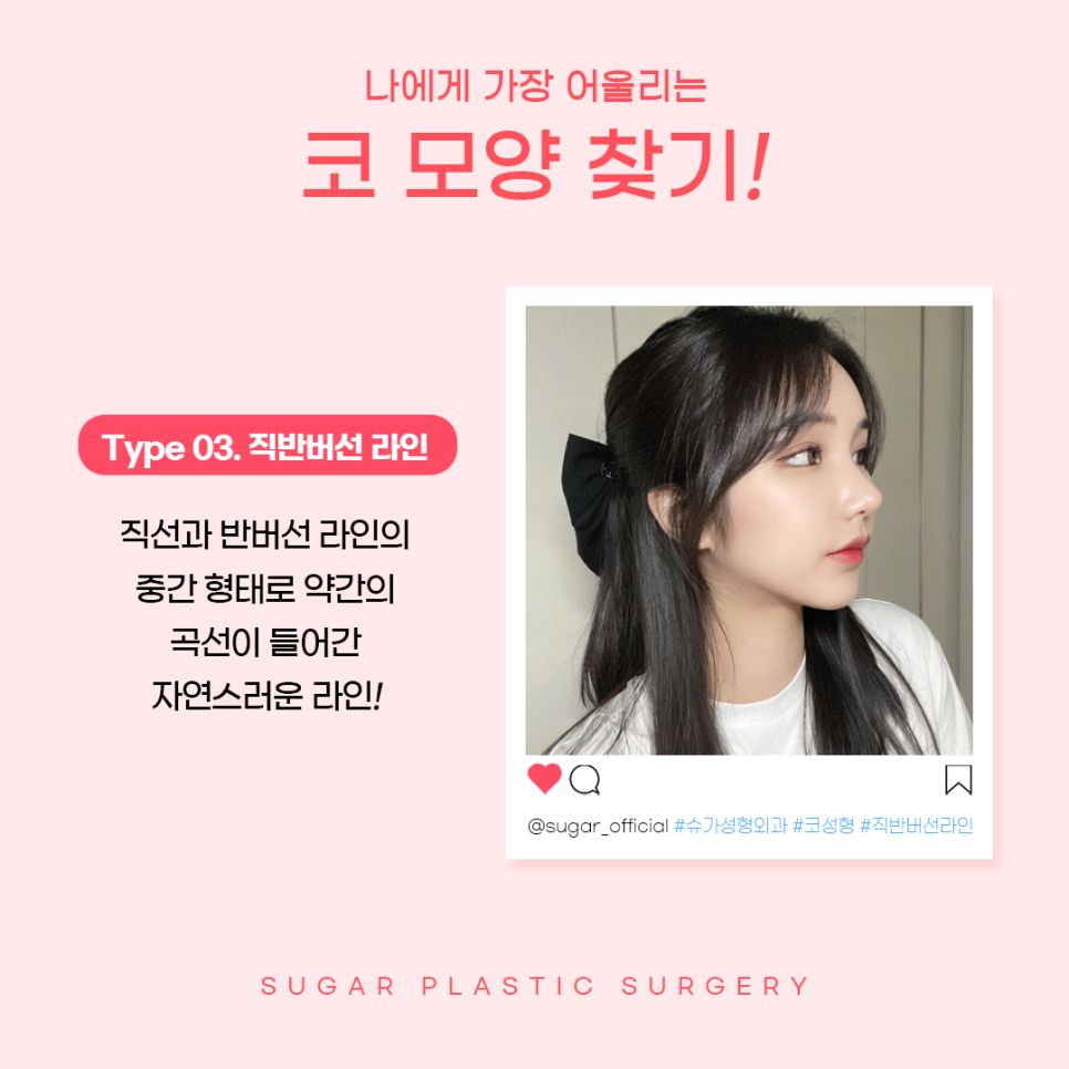 코성형후기 어떻게 알아볼까요? 관련 이미지 4