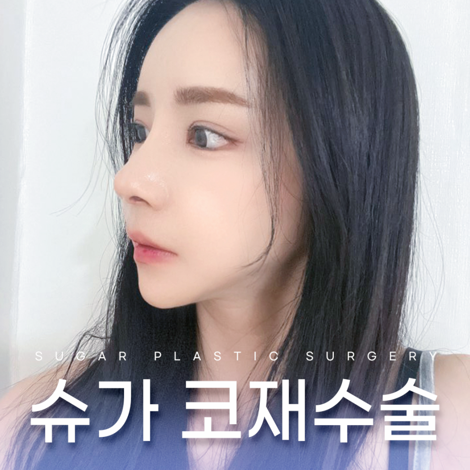 코재수술 그 유형과 해결방법은? 관련 이미지 1