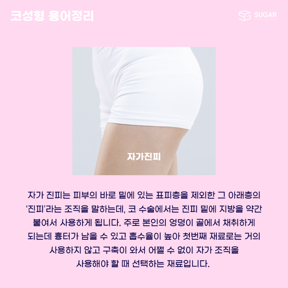 코성형 처음이라면? 용어정리! 관련 이미지 5