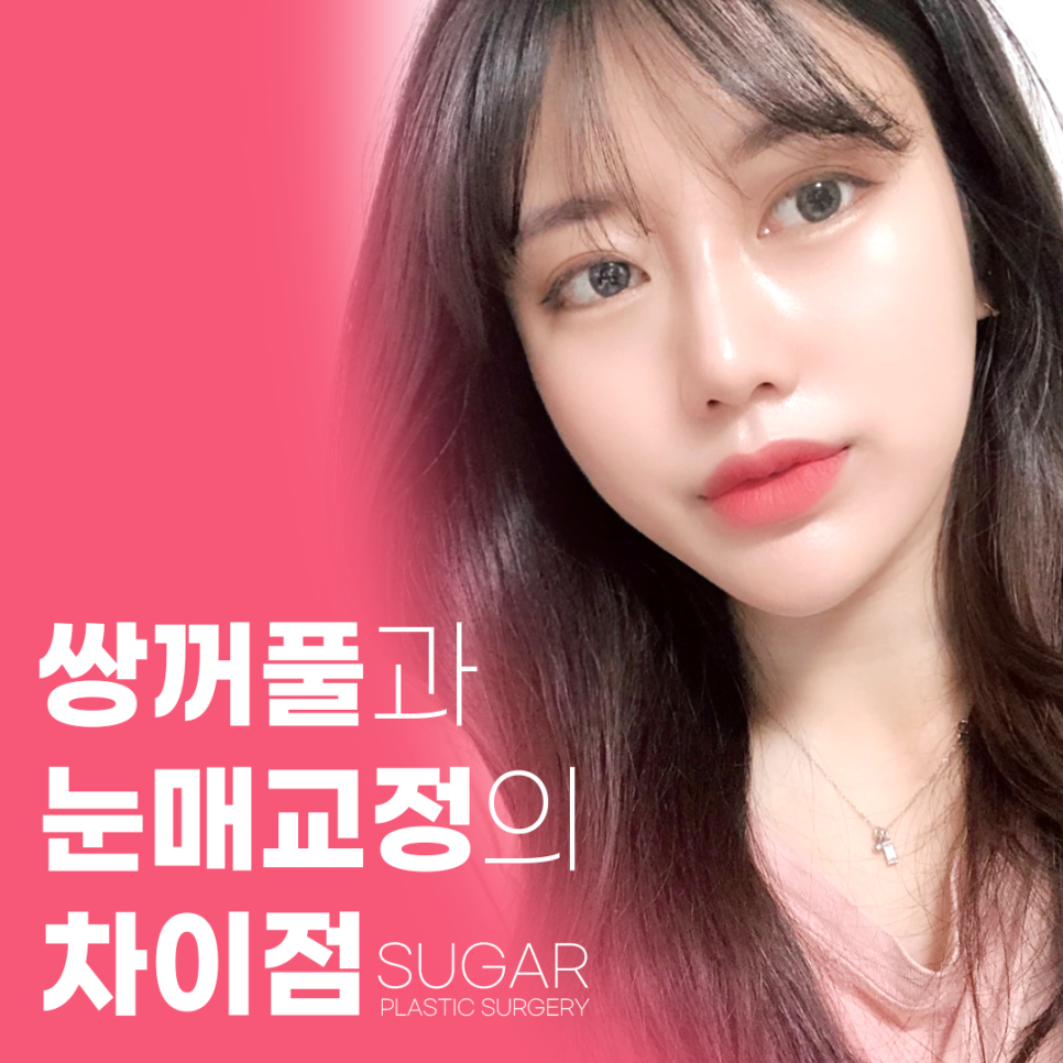 쌍꺼풀과 눈매교정의 차이점 관련 이미지 1