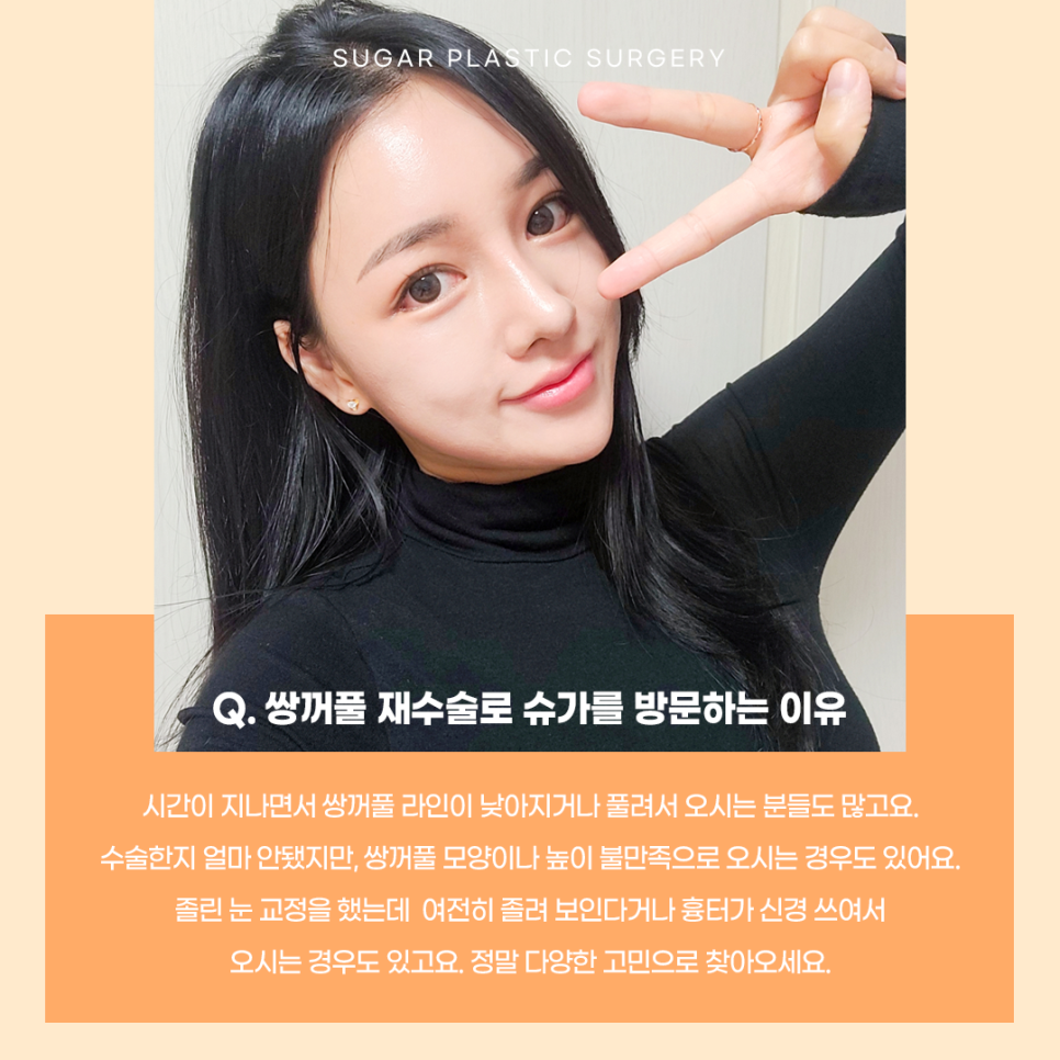 눈재수술 최대 몇 번까지 가능할까? 관련 이미지 2