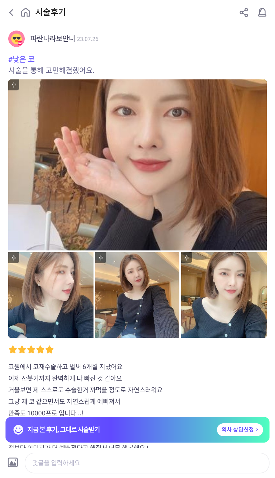 코원성형외과 코재수술성형외과에서 자가늑코재수술로 원하는 코를 주셨어요! 관련 이미지 5