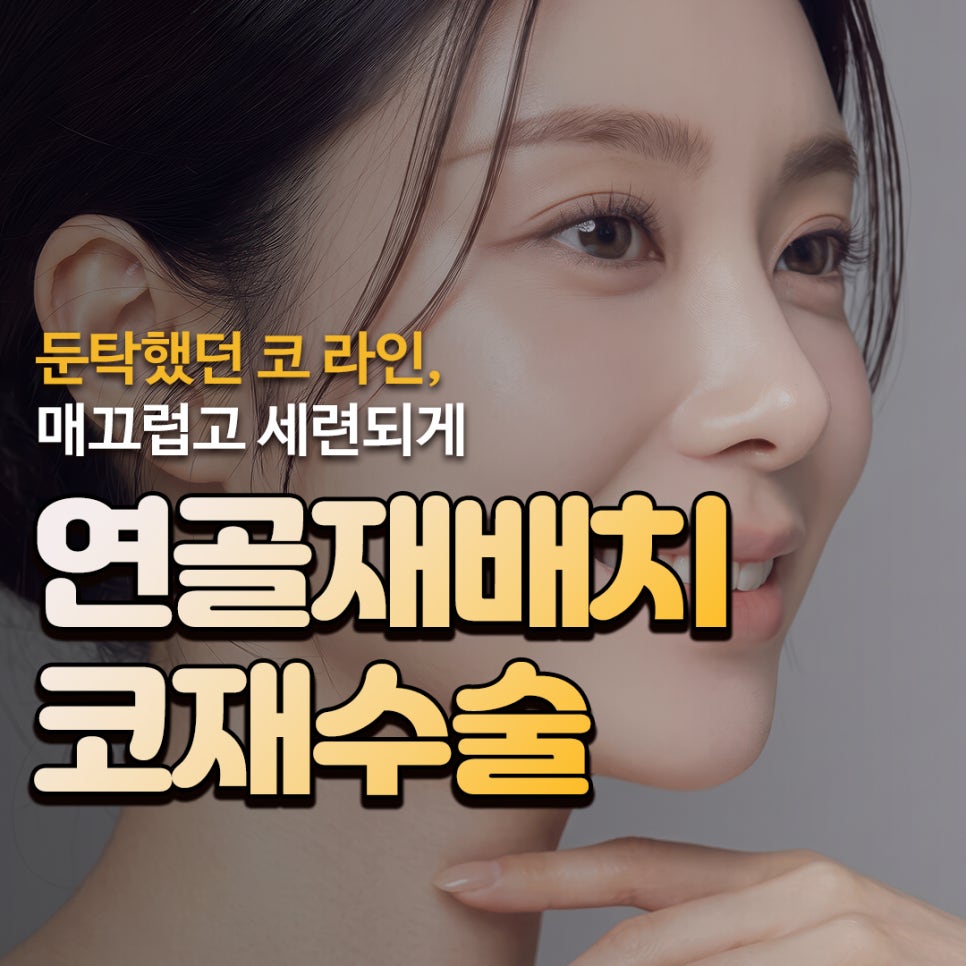 약해진 연골 구조 개선과 코끝 연골재배치로 보는 코재수술 성형외과 성공 사례 관련 이미지 1