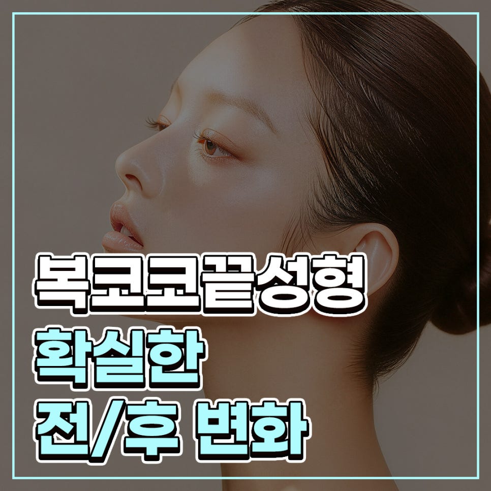 복코코끝성형 전후, 퍼진 코끝과 둔한 콧대 개선 과정 알아봐요 관련 이미지 1