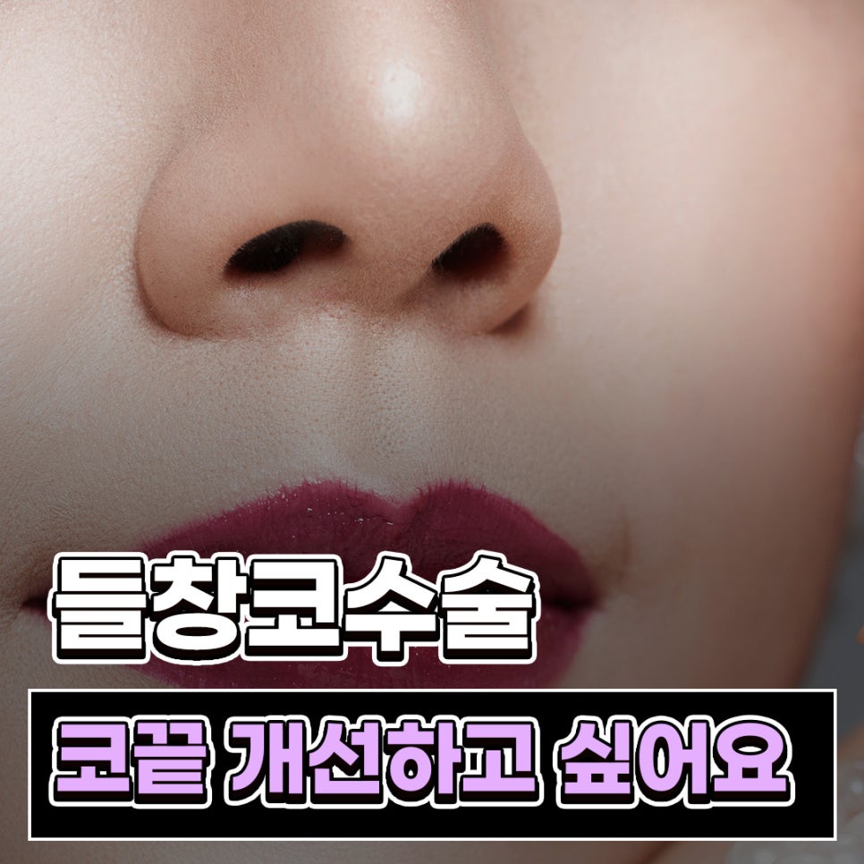 Q. I want to improve my nostrils without artificial implants in upturned nose surgery image 1