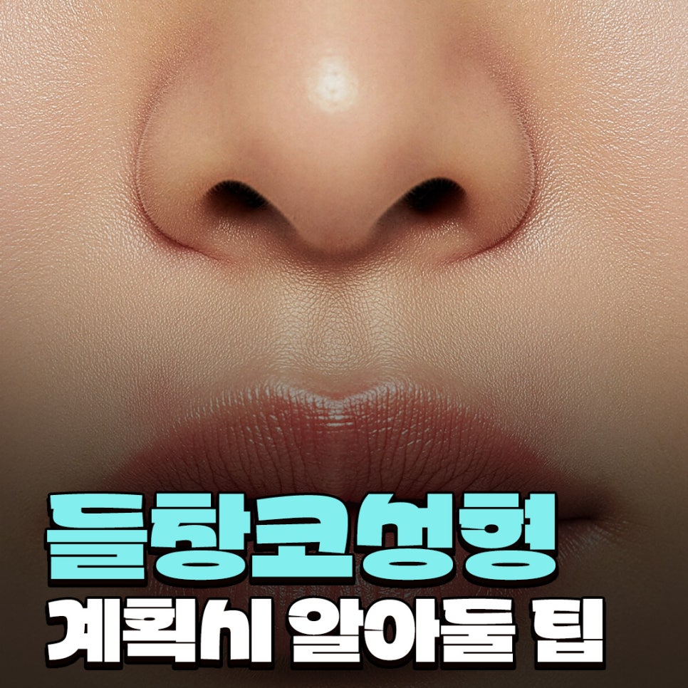 들창코성형 정면에서 콧구멍이 많이 보일 때 코끝 방향을 먼저 보는 이유 관련 이미지 1