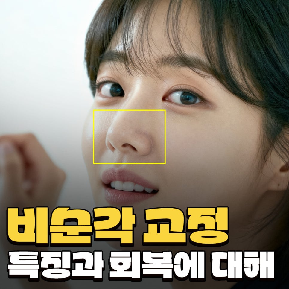 비순각교정 VS 단순 코높임 차이점과 회복에 대하여 관련 이미지 1