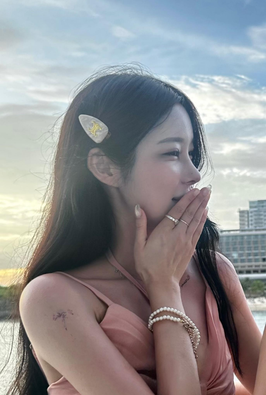I successfully got the nose shape I wanted with 비순각 surgery and low-nose rhinoplasty! image 8