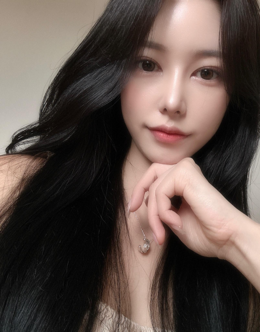 I successfully got the nose shape I wanted with 비순각 surgery and low-nose rhinoplasty! image 6