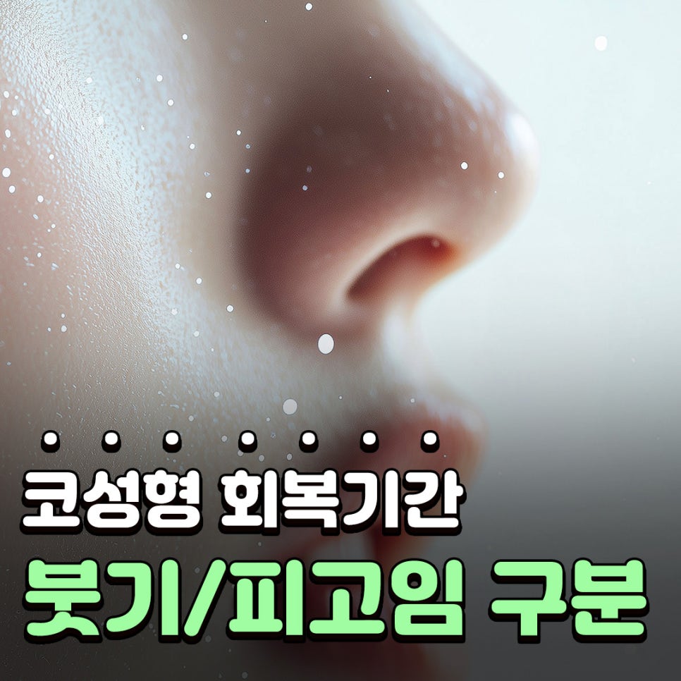 Q. 코성형 회복기간 동안 붓기와 피고임 구분, 콧대재수술 시기 정리 관련 이미지 1