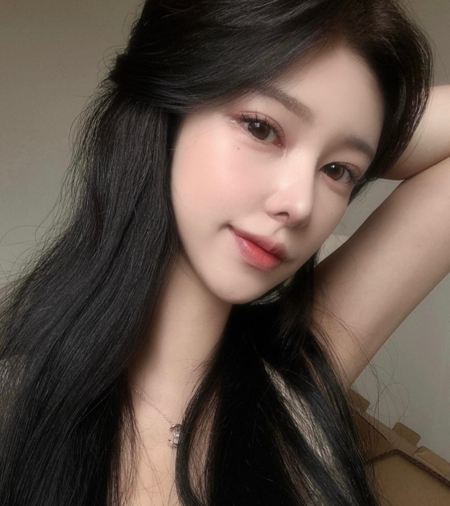 I successfully got the nose shape I wanted with 비순각 surgery and low-nose rhinoplasty! image 5