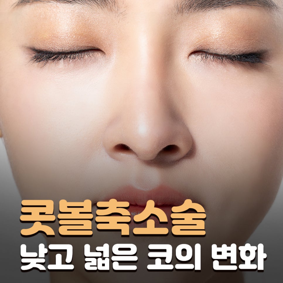 복코 교정, 콧대부터 코끝까지 달라지는 콧볼축소수술전후 모습 관련 이미지 1