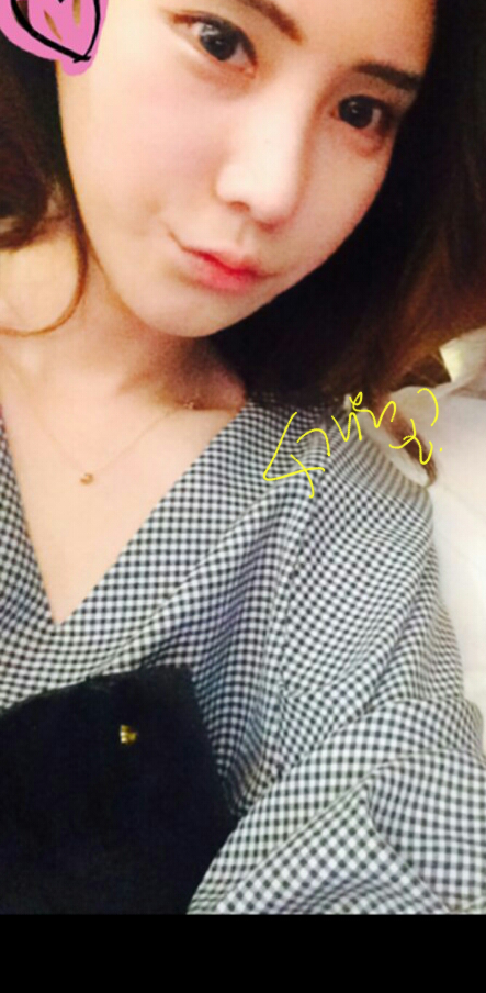 Q. 수술 후 코끝처짐, 개선 방법이 코재수술밖에 없나요? 관련 이미지 6