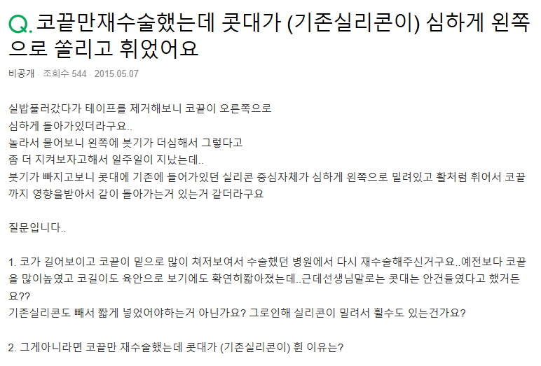 Q. 코끝만 코재수술, 기존 실리콘 휘어졌어요. 관련 이미지 2
