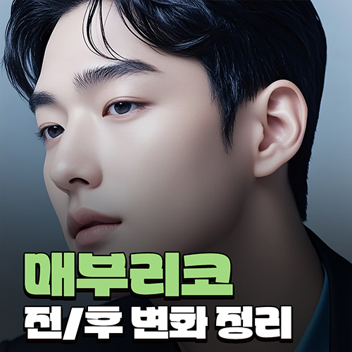 What Are the Criteria for Choosing a Good Place for Men’s Rhinoplasty? A Summary of Changes Before and After a Hump Nose Correction image 1