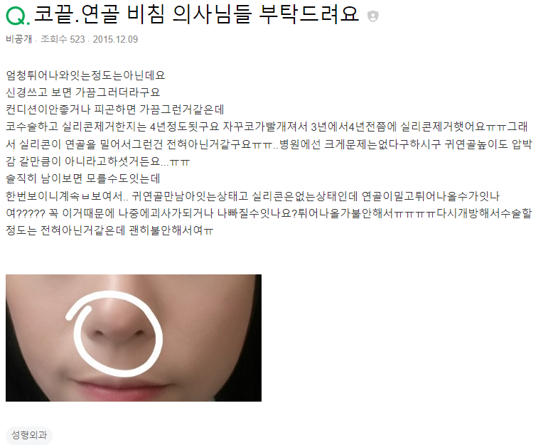 Q. 귀연골로 코 수술, 실리콘 제거 후에도.. 관련 이미지 2