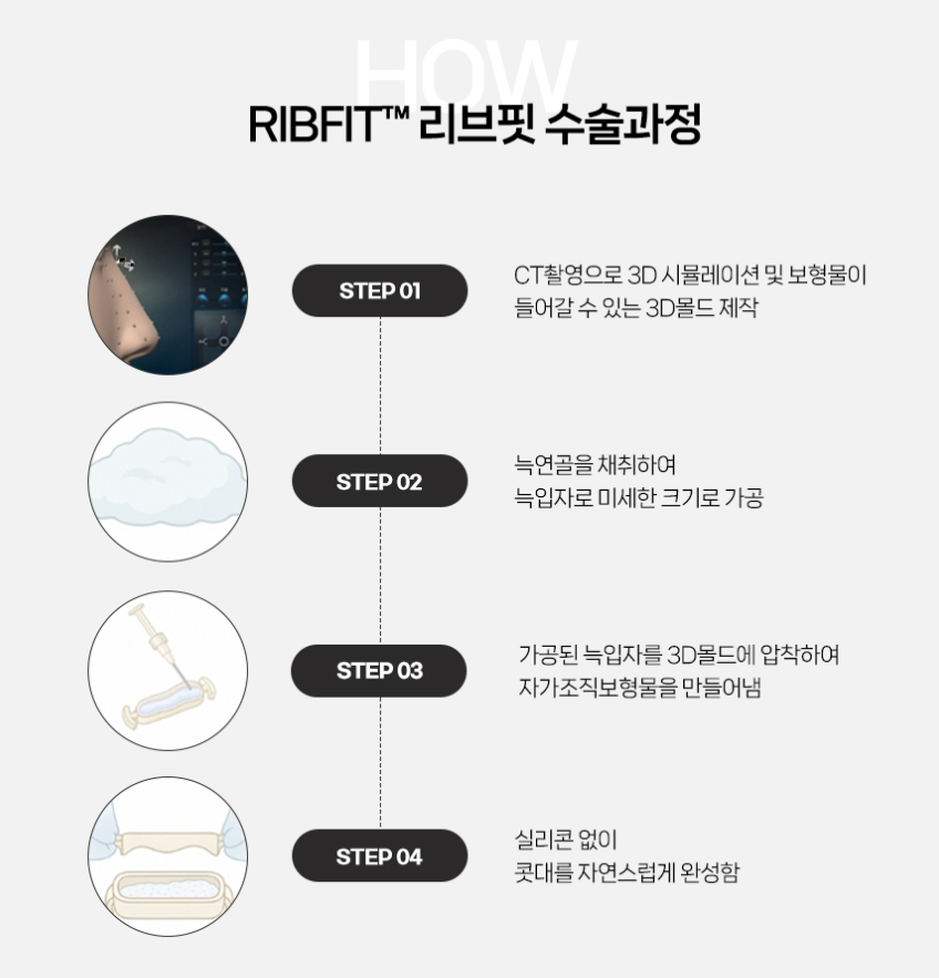 Q. 코성형 티 안나는 방법? A. 자가조직 보형물 리브핏으로 관련 이미지 7