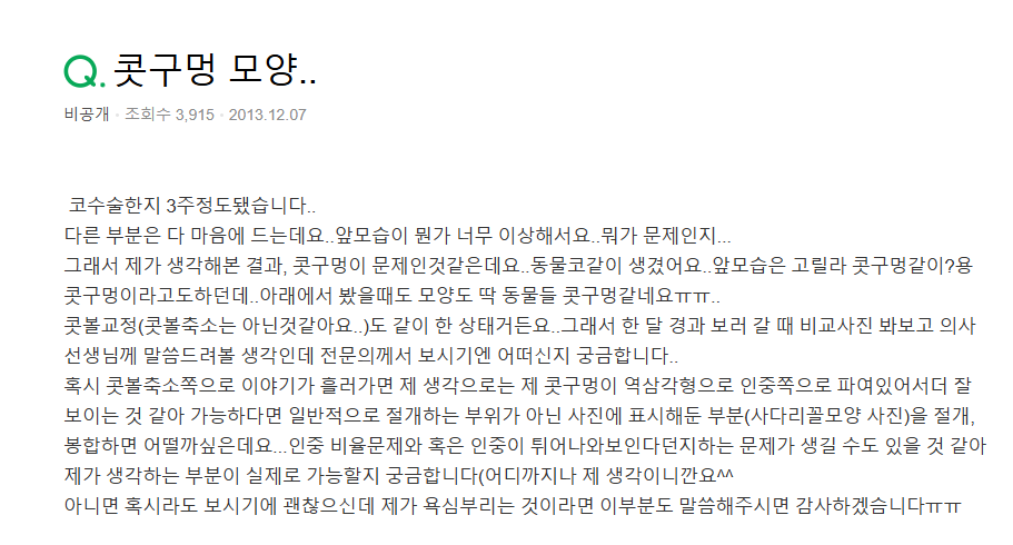 Q. 고민 about alar base surgery: do the nostrils need shape correction? image 2