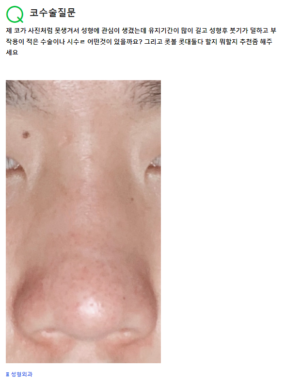 Q. 못생긴코, 코수술 질문 입니다. 관련 이미지 2