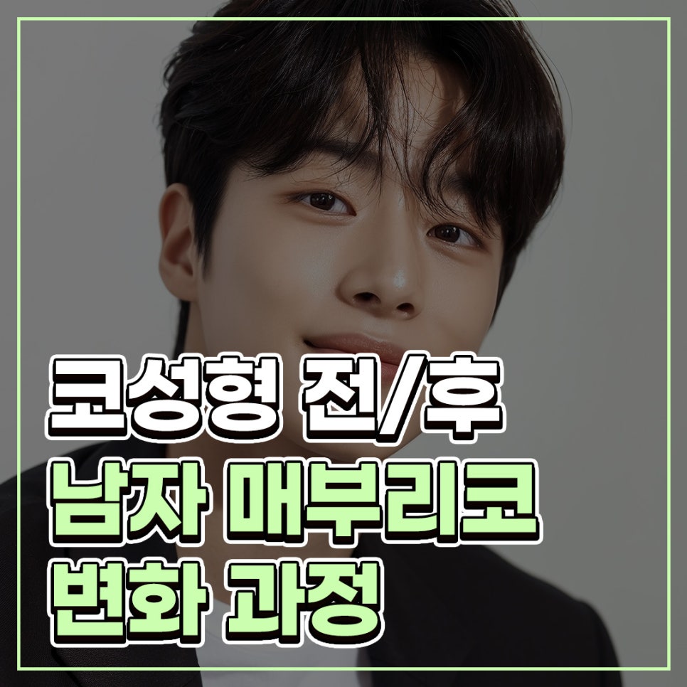 남자코성형전후 매부리코 수술에서 콧대와 코끝을 함께 보는 이유 관련 이미지 1