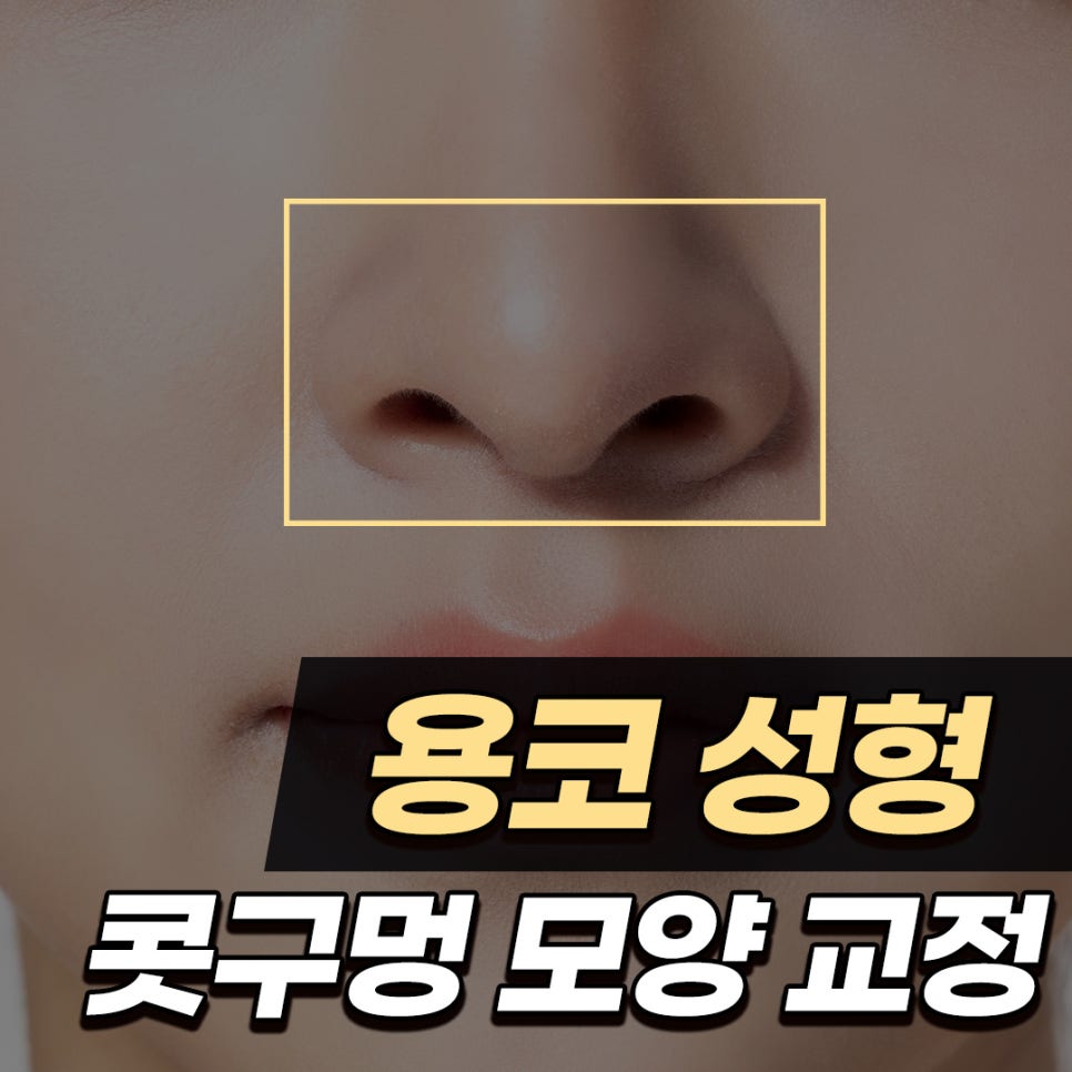 Q. 고민 about alar base surgery: do the nostrils need shape correction? image 1