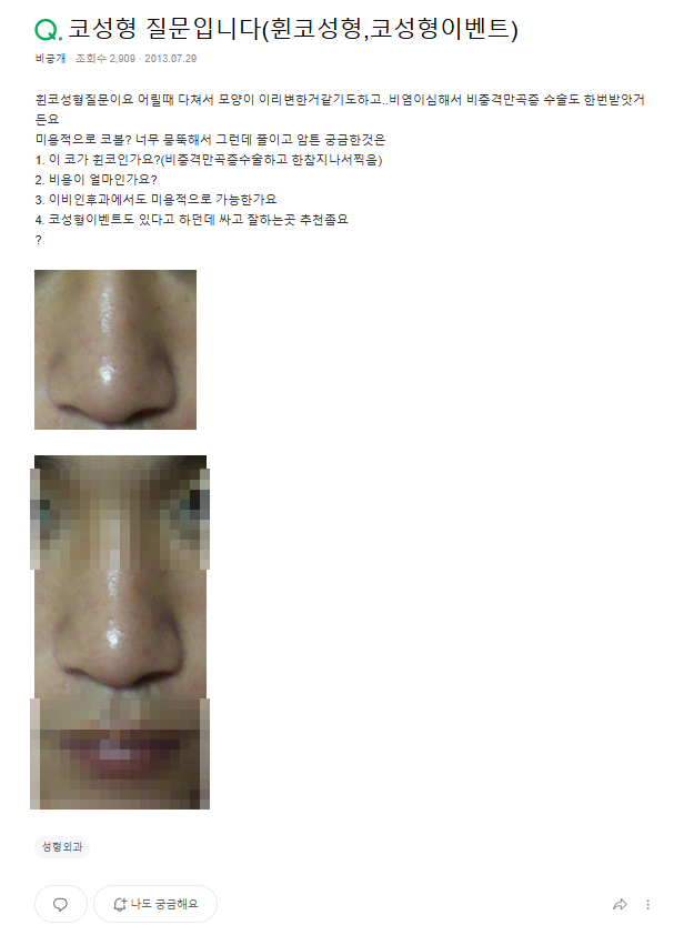 Q. 비중격만곡증 수술 경험 후 복코 관련해서 남자코성형 고민입니다. 관련 이미지 2