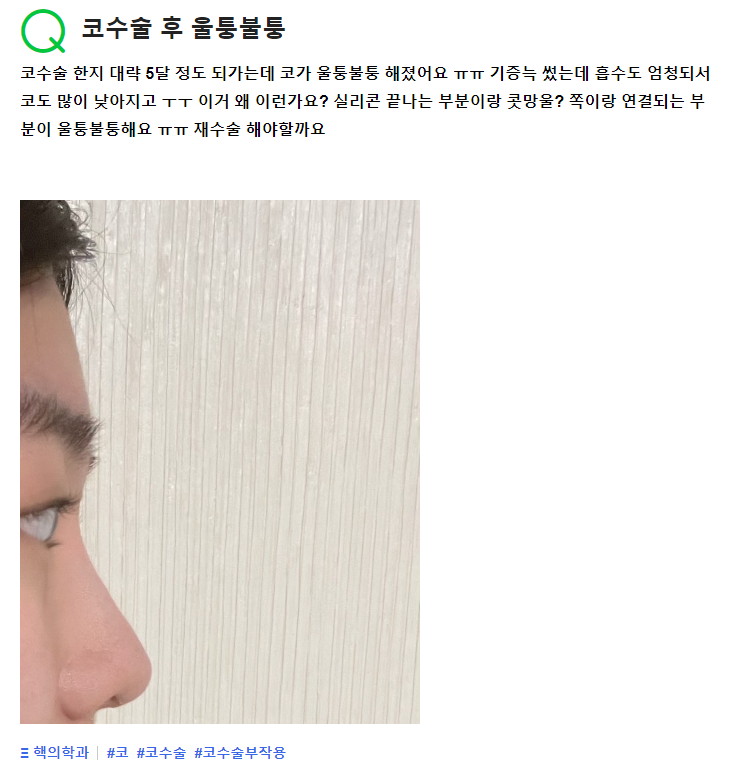 Q. I’m worried because my nose looks bumpy image 2