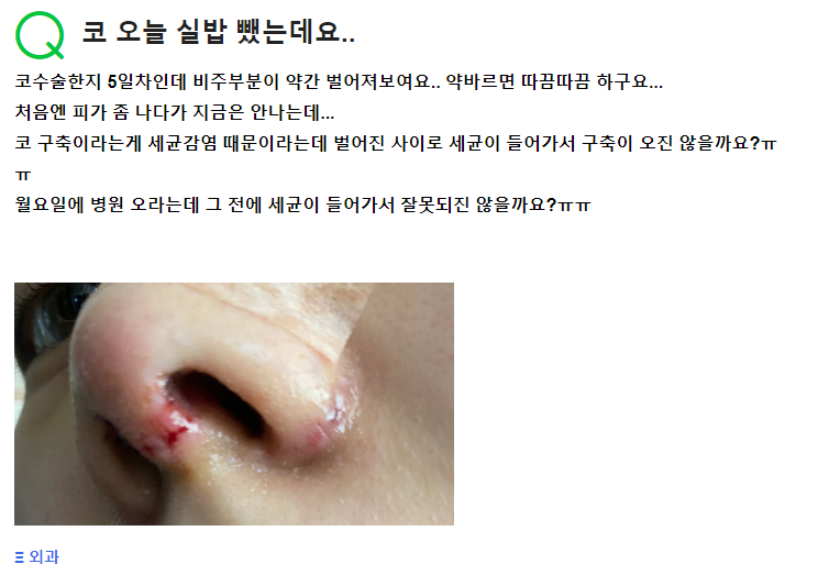 Q. Five days after nose surgery, I had the stitches removed. It won’t cause a contracture nose, right? image 2