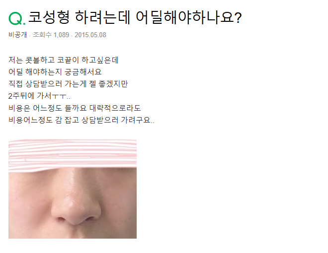 Q. Should a Hump Nose Be Improved with the Septum? image 2
