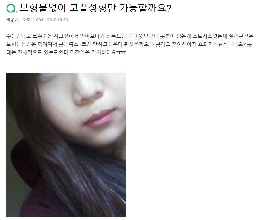 무보형물코수술로 콧볼축소와 코끝 성형 가능할까요? 관련 이미지 2