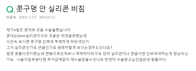 Q. 코안 실리콘 비침? 연골인가요? 관련 이미지 2